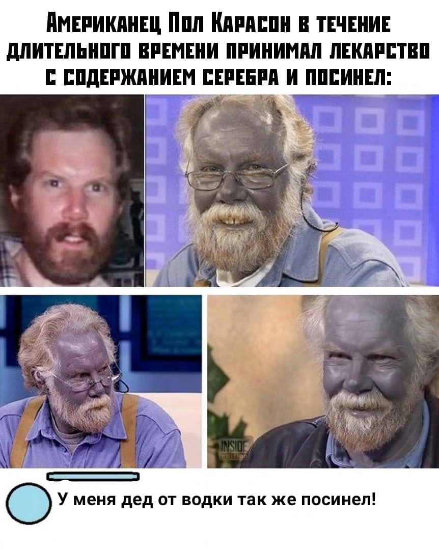 дмнпикпнш Ппп Кпппппн ТЕЧЕНИЕ дпитшьнпгп впнмнни ппинимпл пнкппптвп пднпжпнинм штл и пппиннп У меня дед от водки так же посинел