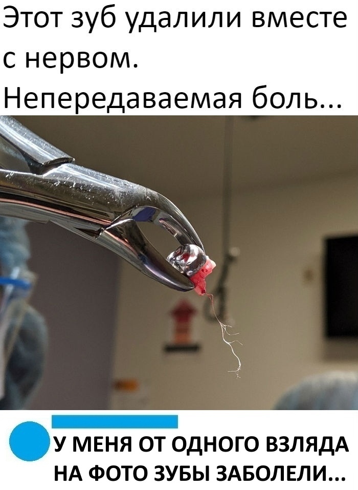 Этот зуб удалили вместе с нервом Непередаваемая боль У МЕНЯ ОТ ОДНОГО ВЗЛЯДА НА ФОТО ЗУБЫ ЗАБОЛЕЛИ