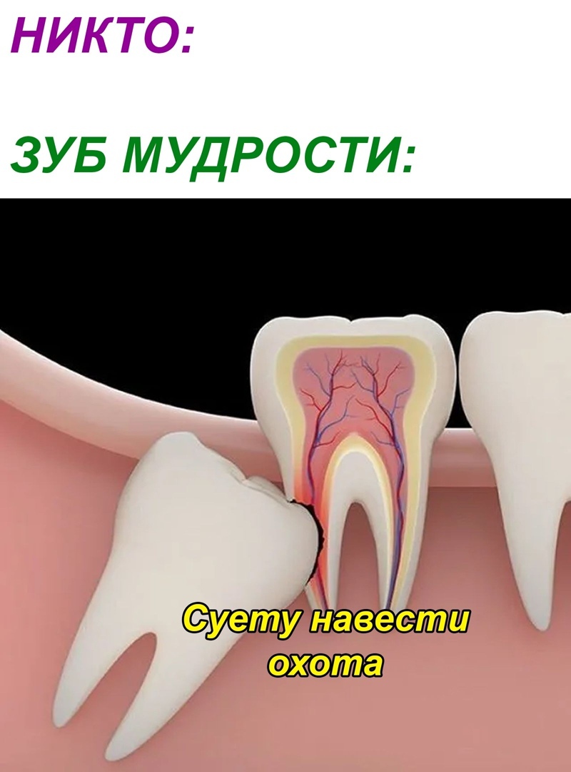 НИКТО ЗУБ МУДРОСТИ