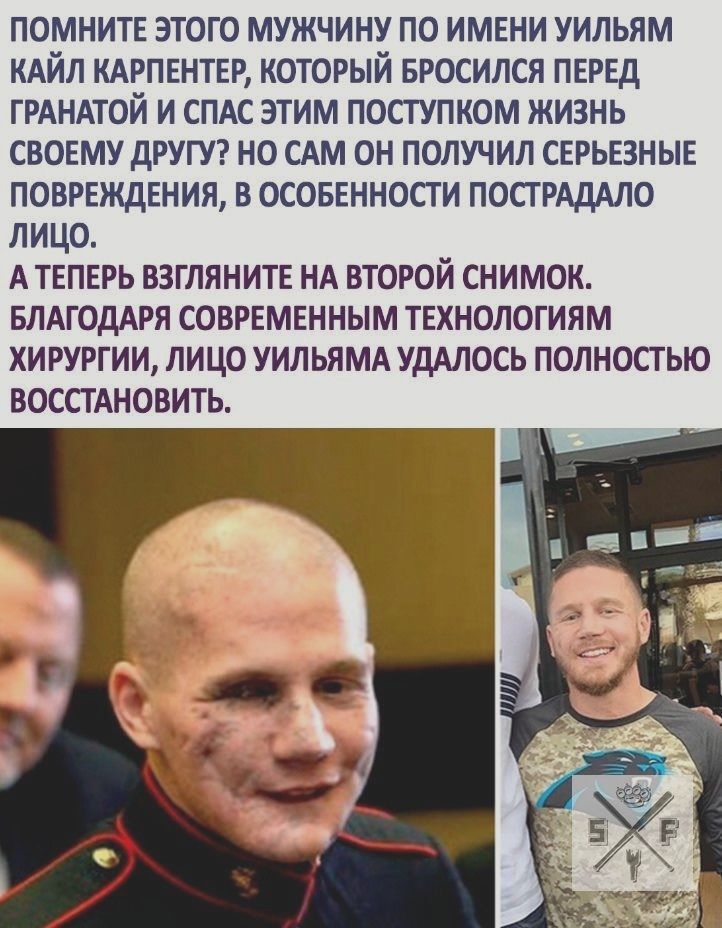 помните этого мужчину по имени уильям КАЙЛ КАРПЕНТЕР который вросился перед ГРАНАТОЙ и спдс этим посгупком жизнь своему другур но САМ он получил серьезные повреждения в осовенности ПОСТРАдАЛО лицо А теперь взгляните НА второй снимок БЛАГОДАРЯ СОВРЕМЕННЫМ ТЕХНОЛОГИЯМ ХИРУРГИИ ЛИЦО УИЛЬЯМА УДАЛОСЬ ПОЛНОСТЬЮ ВОССТАНОВИТЬ