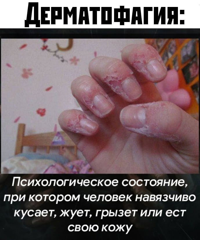 А Психологическое состояние при котором человек навязчиво кусает жует грызет или ест свою кожу