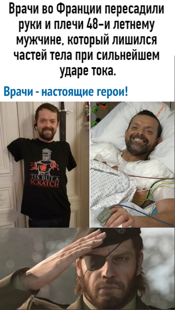 Врачи во Франции пересадили руки и плечи 48 м летнему мужчине который лишился частей тела при сильнейшем ударе тока