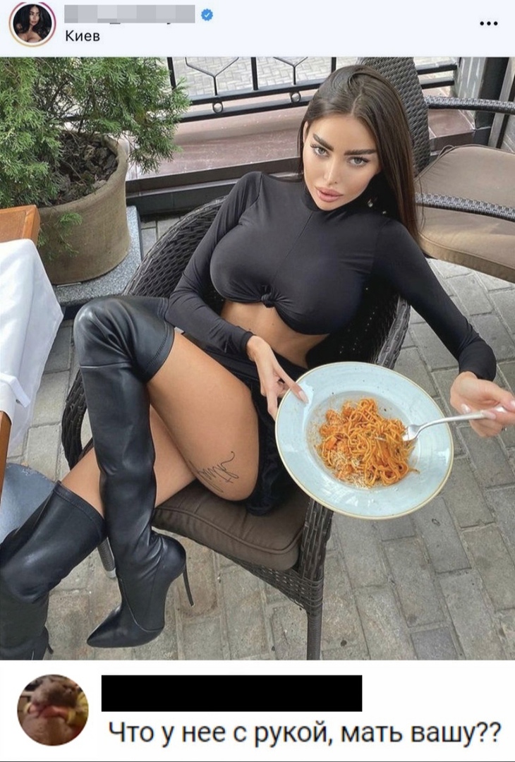 т Что у нее с рукой мать вашу