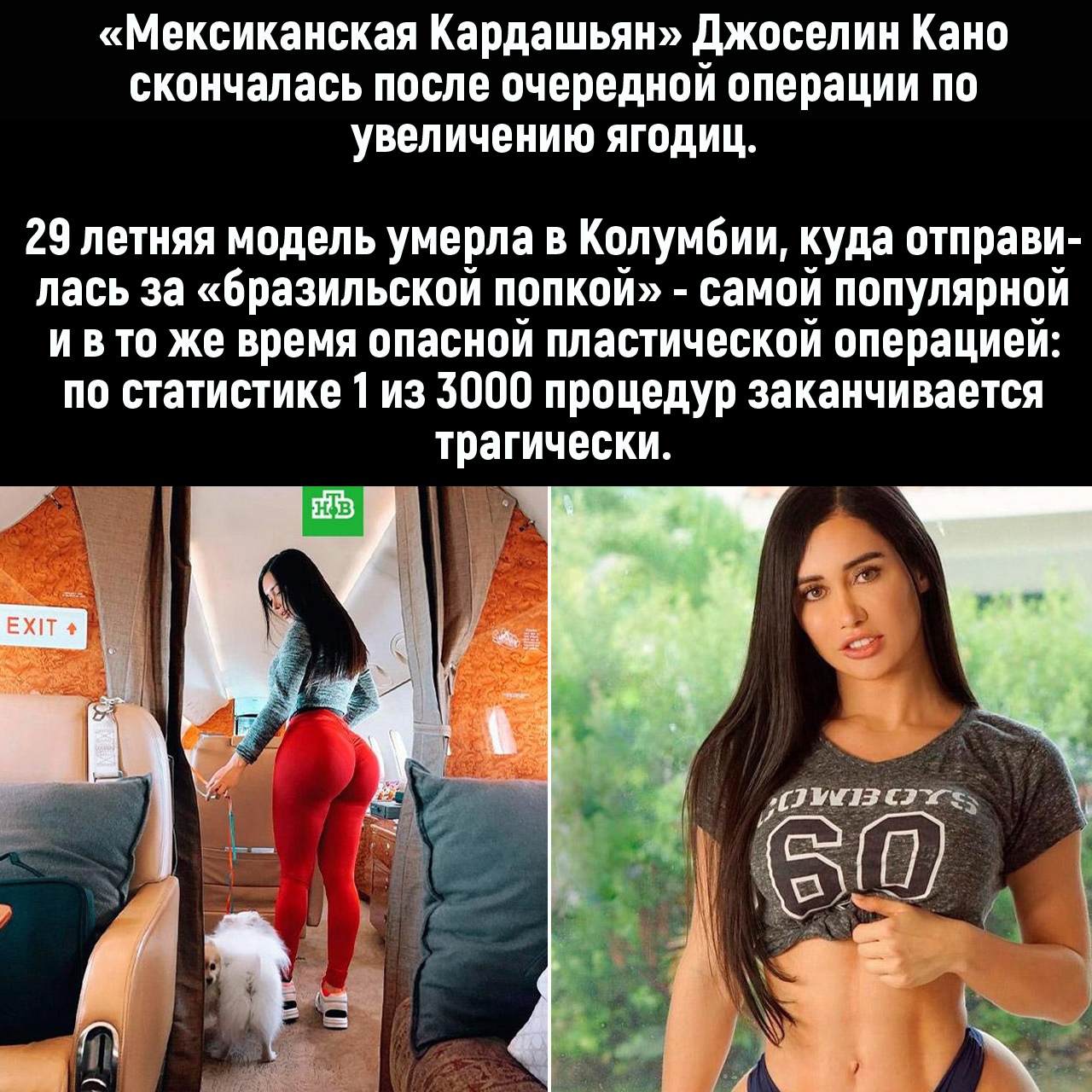 Мексиканская Кардашьян джоселин Кано скончалась после очередной операции по увеличению ягодиц 29 летняя модель умерла в Колумбии куда отправи лась за бразильской попкой самой популярной и в то же время опасной пластической операцией по статистике 1 из 3000 процедур заканчивается трагически