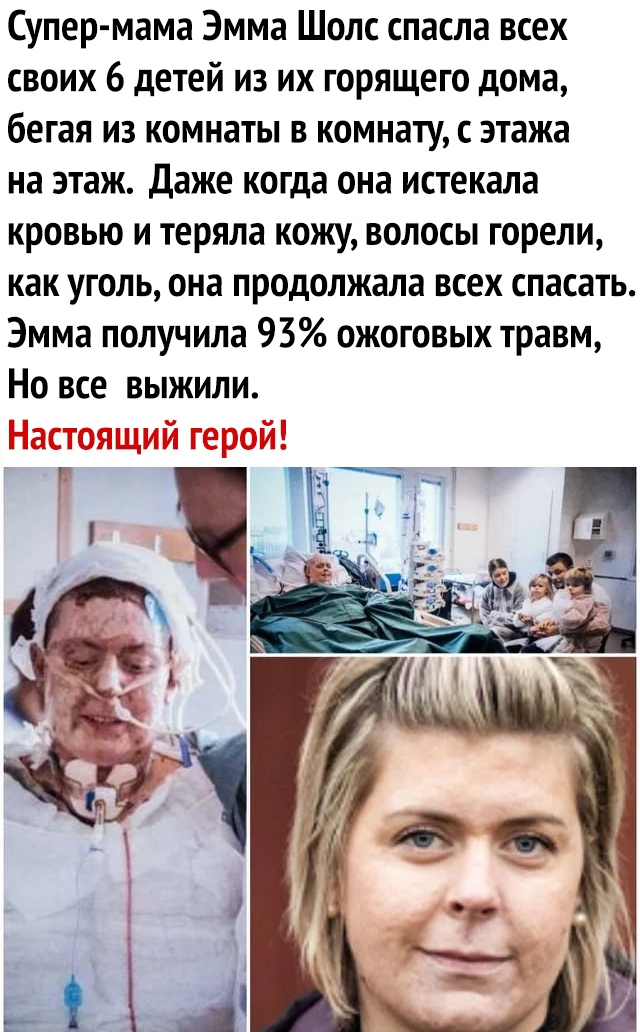 Супер мама Эмма Шолс спасла всех своих 6 детей из их горящего дома бегая из комнаты в комнату этажа на этаж Даже когда она истекала кровью и теряла кожу волосы горели как уголь она продолжала всех спасать Эмма получила 93 ожоговых травм Но все выжили