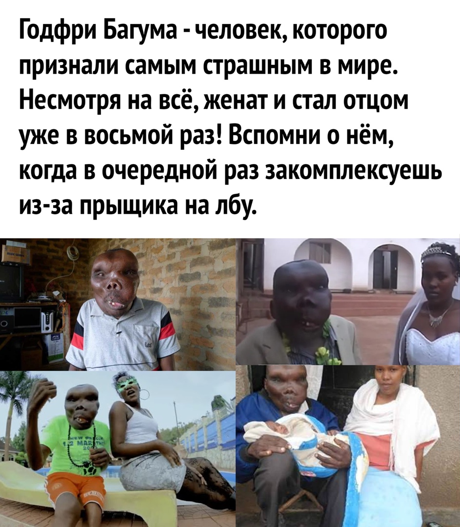 Годфри Багума человек которого признали самым страшным в мире Несмотря на всё женат и стал отцом уже в восьмой раз Вспомни о нём когда в очередной раз закомплексуешь из за прыщика на лбу