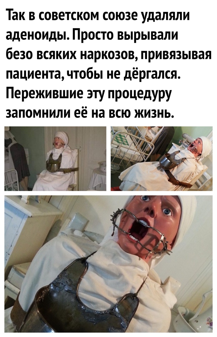 Так в советском союзе удаляли аденоиды Просто вырывали безо всяких наркозов привязывая пациента чтобы не дёргался Пережившие эту процедуру