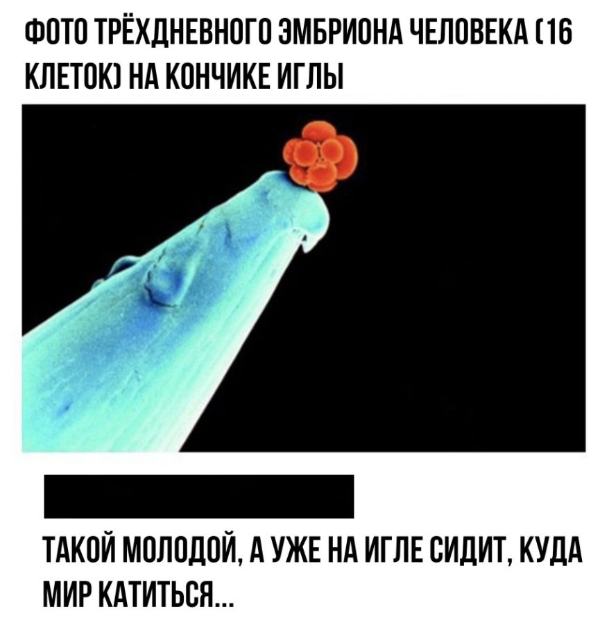 ФОТО ТРЁХДНЕВНПГО ЗМБРИПНА ЧЕЛОВЕКА 16 КЛЕТОК НА КОНЧИКЕ ИГЛЫ ТАКОЙ МОЛОДОЙ А УЖЕ НА ИГЛЕ СИДИТ КУДА МИР КАТИТЬСЯ