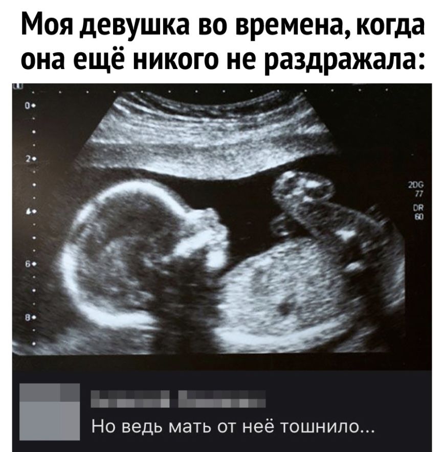 Моя девушка во времена когда она ещё никого не раздражала