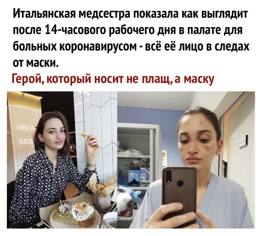 Итальянская медсестра показала как выглядит после 14 часового рабочего дня в палате для больных коронавирусом всё её лицо в следах от маски Герой который носит не плаща маску