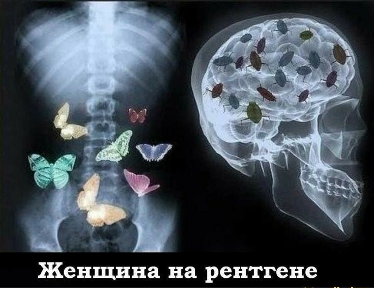 Женщина на рентгене