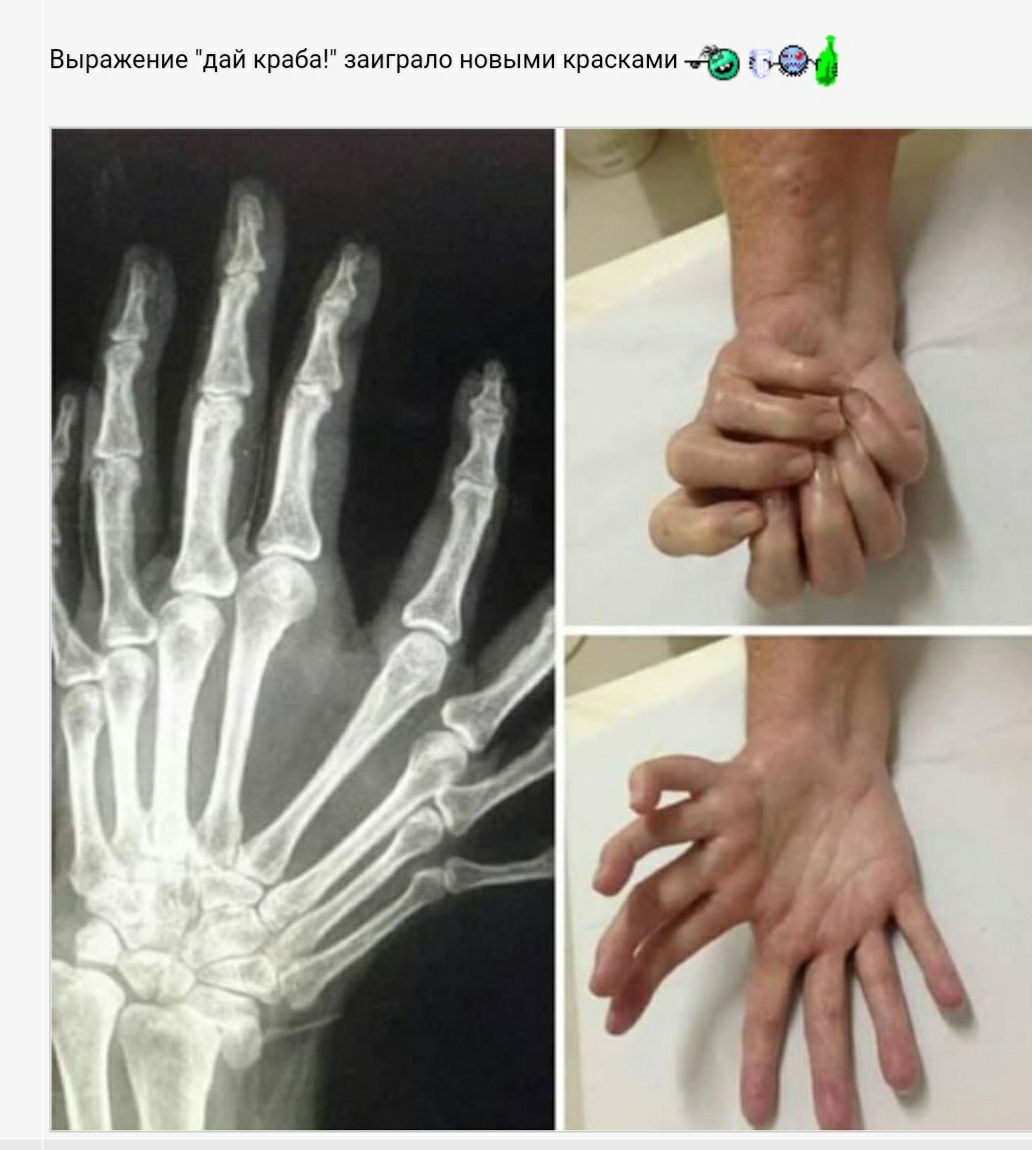 Выражение дай краба заиграпо новыми красками _ 1