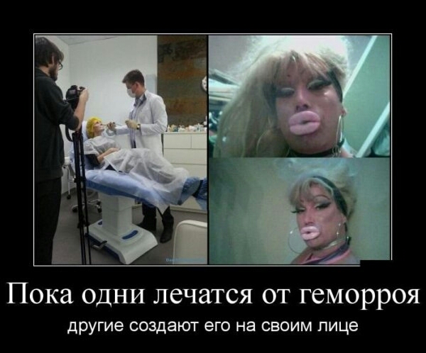 Пока ОДНИ лечатся от геморроя другие создают его на своим лице