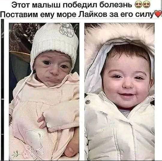 Этот малыш победил болезнь Поставим ему море Лайков за его силуФ