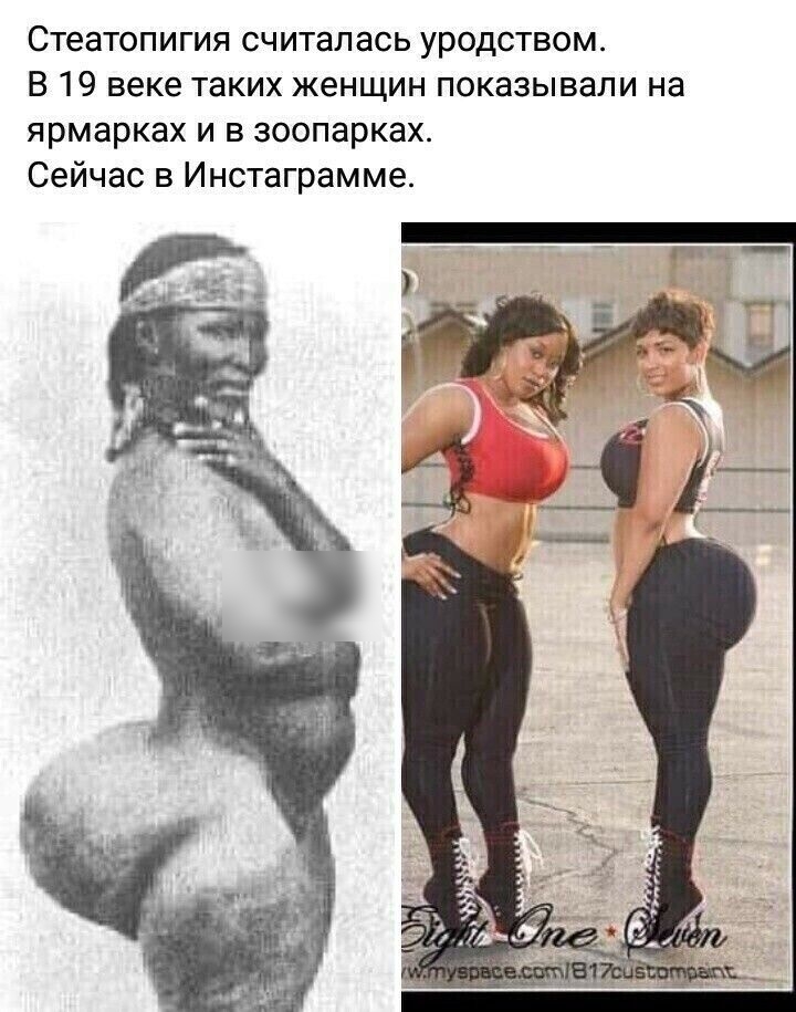 Стеатопигия считалась уродством В 19 веке таких женщин показывали на ярмарках и в зоопарках Сейчас в Инстаграмме
