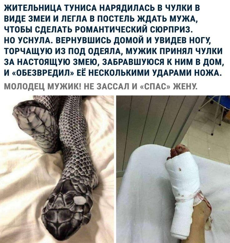 ЖИТЕЛЬНИЦА ТУНИСА НАРЯДИЛАСЬ В ЧУЛКИ В ВИДЕ ЗМЕИ И ЛЕГЛА В ПОСТЕЛЬ ЖДАТЬ МУЖА ЧТОБЫ СДЕЛАТЬ РОМАНТИЧЕСКИЙ СЮРПРИЗ НО УСНУЛА ВЕРНУВШИСЬ дОМОЙ И УВИДЕВ НОГУ ТОРЧАЩУЮ ИЗ ПОД ОДЕЯЛА МУЖИК ПРИНЯЛ ЧУЛКИ ЗА НАСТОЯЩУЮ ЗМЕЮ ЗАБРАВШУЮСЯ К НИМ В ДОМ И ОБЕЗВРЕДИЛ ЕЁ НЕСКОЛЬКИМИ УДАРАМИ НОЖА МОЛОДЕЦ МУЖИК НЕ ЗАССАЛ И СПАС ЖЕНУ
