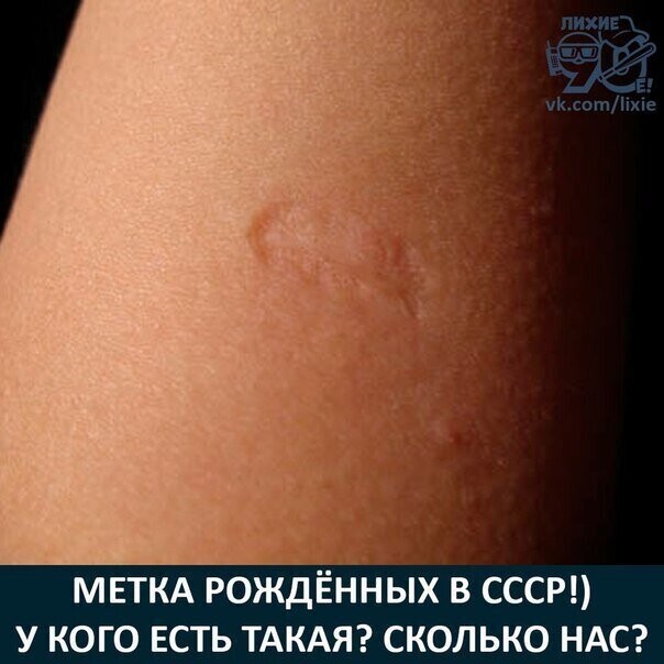МЕТКА РОЖДЁННЫХ В СССР У КОГО ЕСТЬ ТАКАЯ СКОЛЬКО НАС