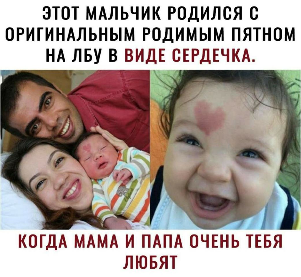 ЭТОТ МАЛЬЧИК РОДИЛОЯ О ОРИГИНАЛЬНЫМ РОДИМЫМ ПЯТНОМ НА ЛБУ В ВИДЕ СЕРДЕЧКА КОГДА МАМА и ПАПА очънь тЕБя лювят