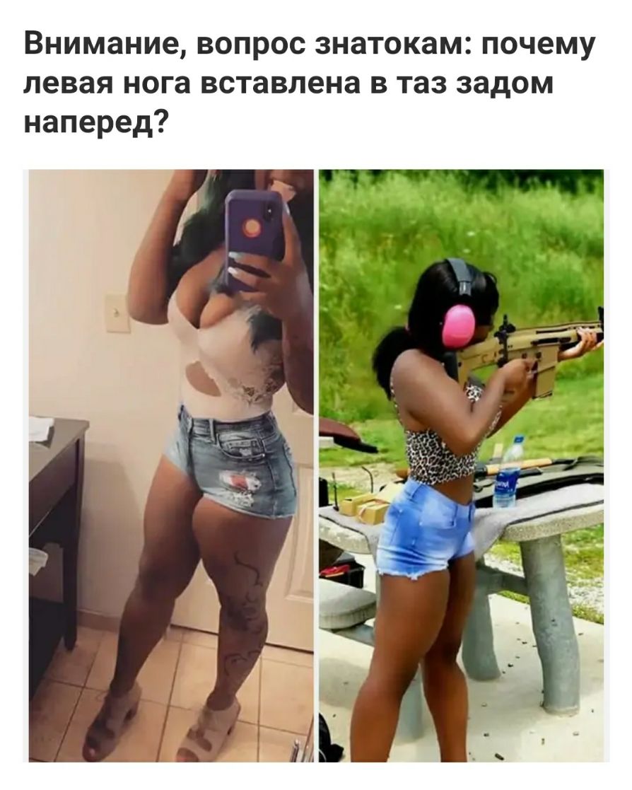 Внимание вопрос знатокам почему левая нога вставлена в таз задом наперед