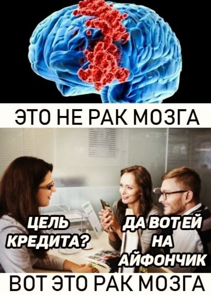 ВОТ ЭТО РАК МОЗГА
