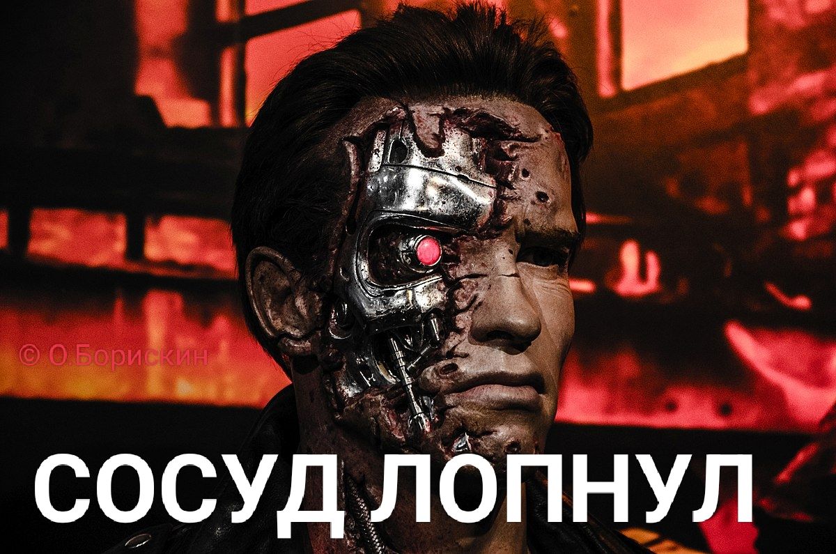 СОСУД ЛОПНУЛ