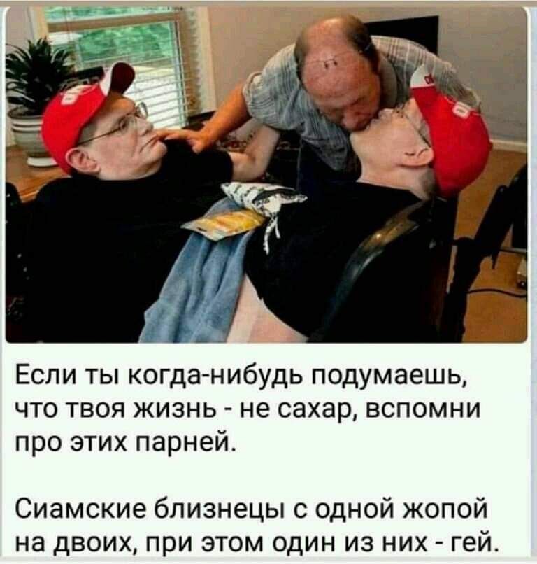 Если ты когда нибудь подумаешь что твоя жизнь не сахар вспомни про этих парней Сиамские близнецы с одной жопой на двоих при этом один из них гей