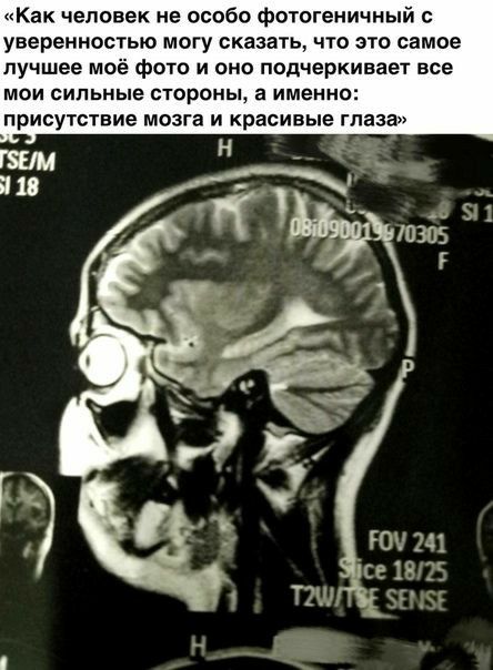 Как человек не особо фотогеничный уверенностью могу сказать что это самое лучшее моё фото и оно подчеркивает все МОИ СИЛЬНЫЕ СТОРОНЫ а ИМЕННО присутствие МОЗГЗ И КРБСИВЫЭ глаза