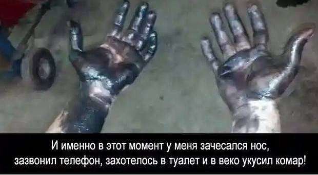 И именно в этот моменту меня зачесался нос зазвонил телефон захотелось в туалет и в веко укусил комар