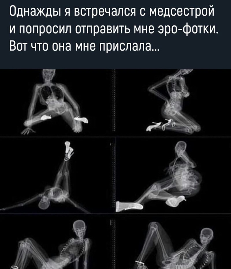 Однажды я встречался с медсестрой и попросил отправить мне эро фотки Вот что она мне прислала