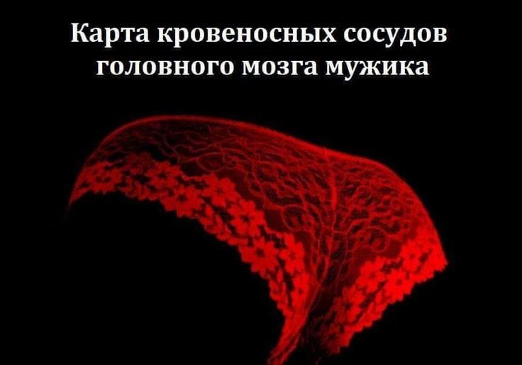 Карта кровеносных сосудов головного мозга мужика