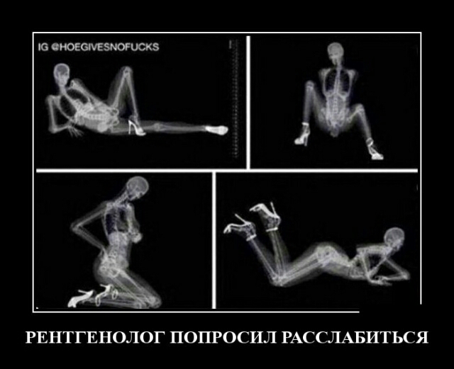 РЕНТГЕНОЛОГ ПОПРОСИЛ РАССЛАБИТЬСЯ