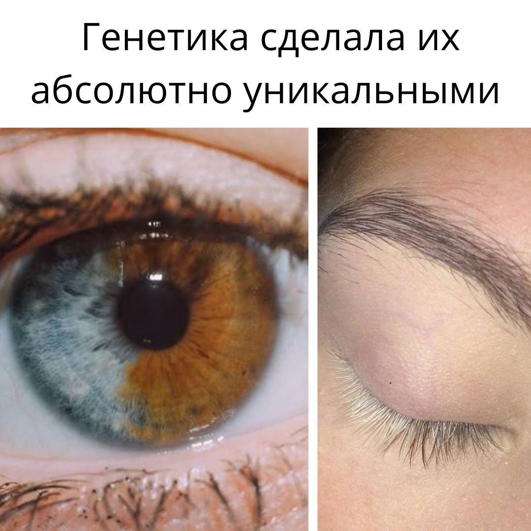 Генетика сделала их абсолютно уникальными