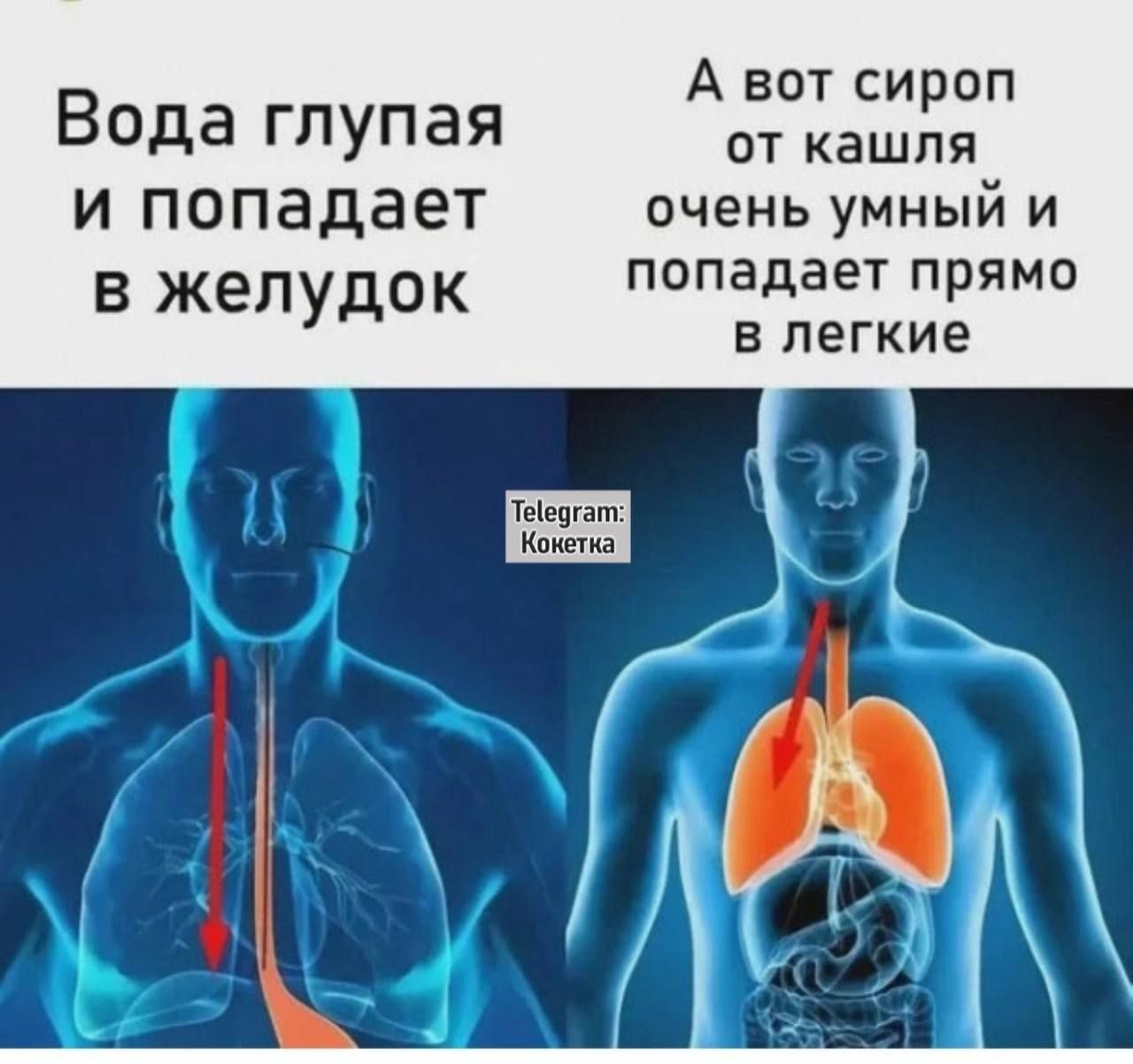 А вот сироп вода глупая от кашдя и попадает очень умный и в желудок попадает прямо в легкие