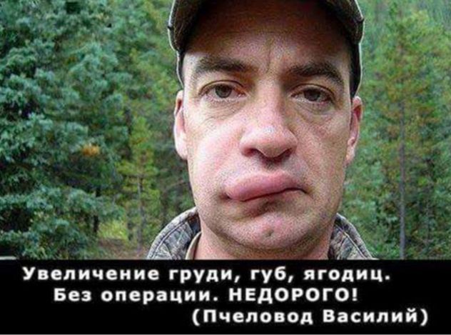 Без операции НЕДОРОГО Пчеловод Василий