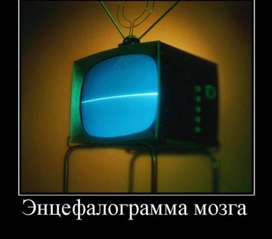 Энцефалограмма мозга