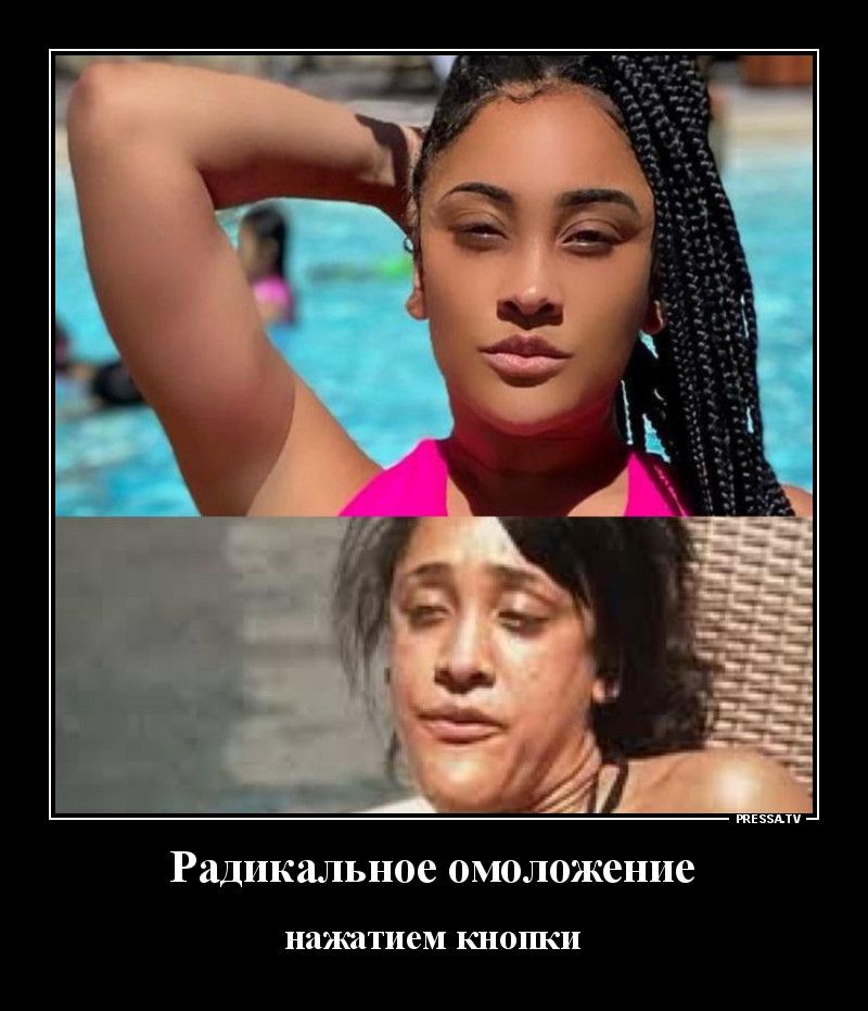 тззми Радикальное омоложение НИЗКЯТИЭМ КНОШСИ
