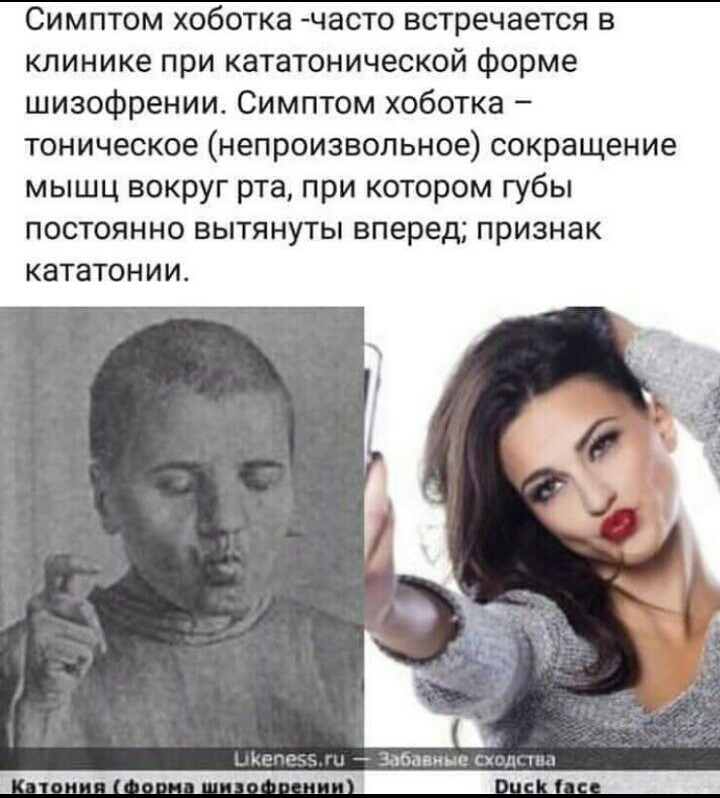 Симптом хоботка часто встречается в клинике при кататонической форме шизофрении Симптом хоботка тоническое непроизвольное сокращение мышц вокруг рта при котором губы постоянно вытянуты вперед признак кататонии __ _апаеиш гг чч Нч