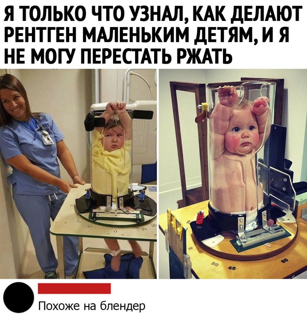 я только что УЗНАЛ КАК дЕЛАЮТ РЕНТГЕН МАЛЕНЬКИМ детям и я не могу пернсшь ржАть 11 Похоже на блендер