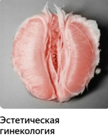 Эстетическая гинекология