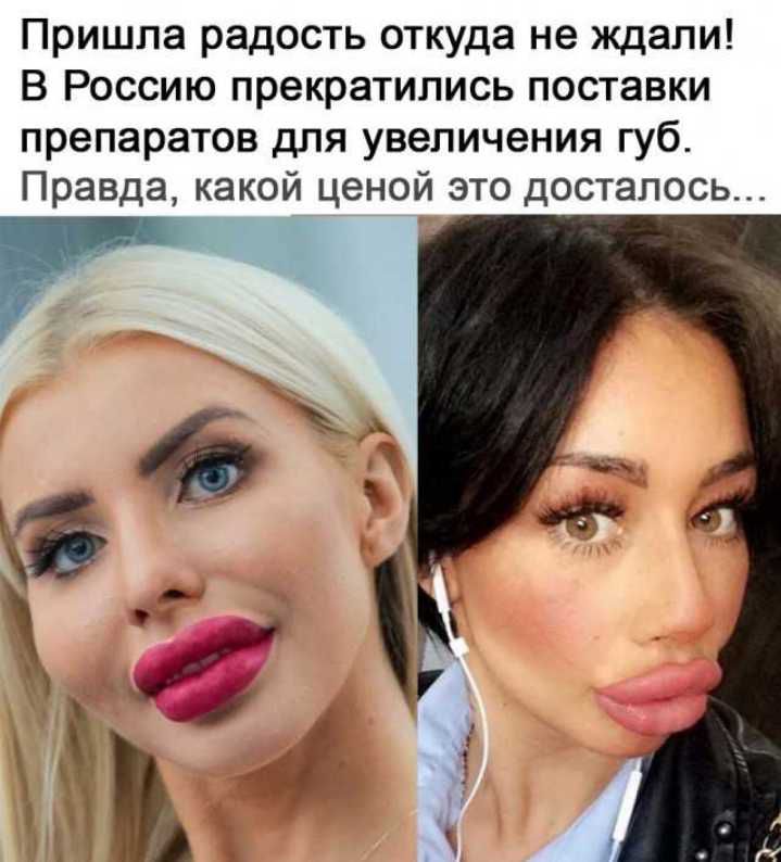 Пришла радость откуда не ждали В Россию прекратились поставки препаратов для увеличения губ Правда какой ценой это досталось