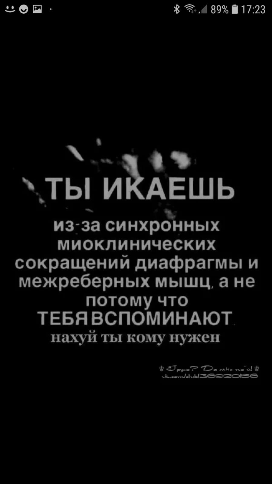 ЗФП ЗЁАПЖ ТЫ И АЕШЬ из за синхронных миоклинических сокращений диафрагмы и межреберных мышца не потому что ТЕБЯ ВСПОМИНАЮТ нахуй ты кому нужен
