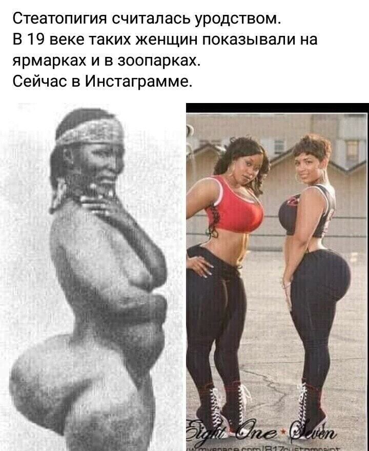 Стеатопигия считалась уродством В 19 веке таких женщин показывали на ярмарках и в зоопарках Сейчас в Инстаграмме