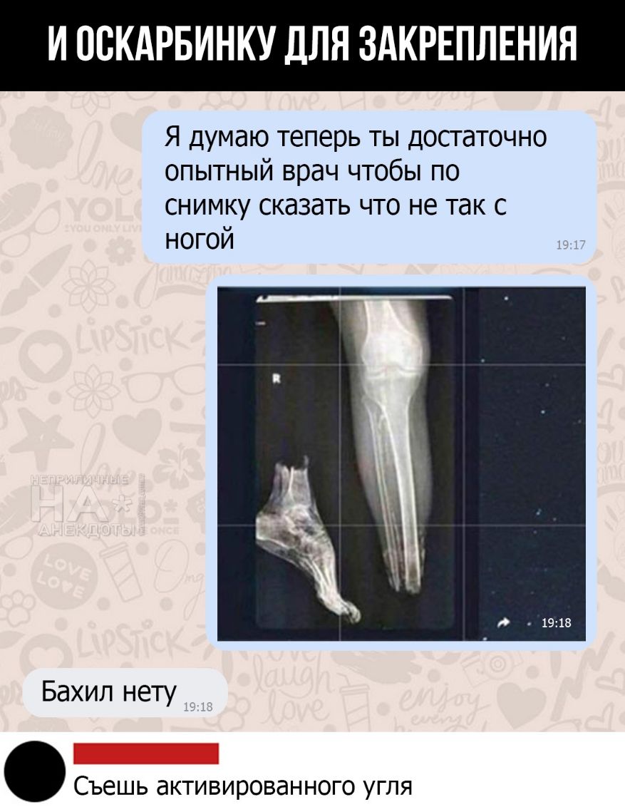 И ОСКАРБИНКУ ДЛЯ ЗАКРЕПЛЕНИЯ Я думаю теперь ты досгаточно опытный врач чтобы по снимку сказать что не так с ногой Бахил нету Съешь активированного угля
