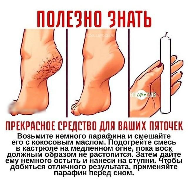 ППЛЕЗНП ЗНдТЬ ПРЕКРПЕНПЕ ЕРЕдЕТВП дЛЯ ВПШЙХ ПЯТПЧЕК Возьмите немного пара ина и смешайте его с кокосовым маслом одогреите смесь в кастрюле на медленном огне пока воен должным образом не растопится Затем аите ему немного остыть и нанеси на ступни тобы добиться отличного результата применяите парафин перед сном