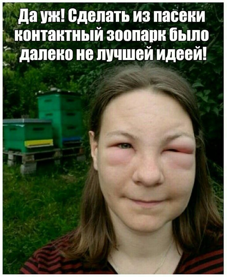 да ши сделать из пасеки контактный зоопарк быпо далеко не лучший идеей в