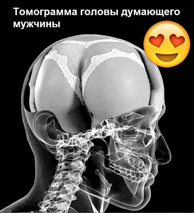 ТОМОГРВМ ма ГОЛОВЫ думающего МУЖЧ И НЬ