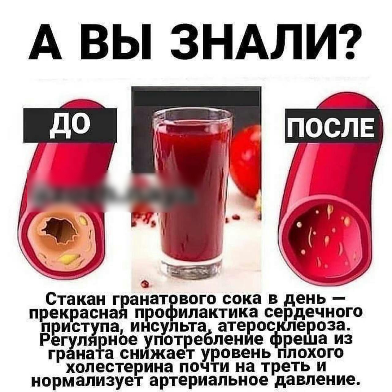 А ВЫ ЗНАЛИ Стаканг гганрат ВОГО сока В день препарасна п о илактика сердечного ст па инс гульта атер ос ероза ля ноеу отребление еша из Ргрн аа снижаету ровень охого холестерина почти на тр еть и нормализует артериальное давление