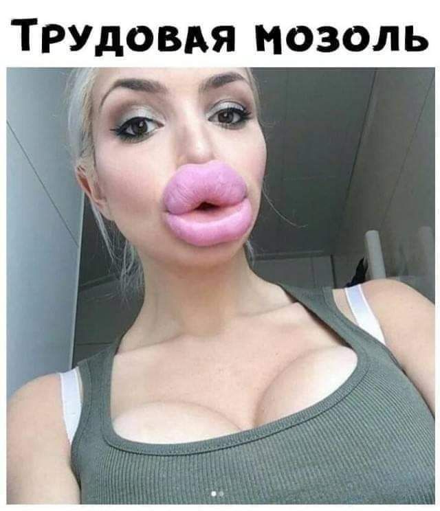 Трудовдя мозоль