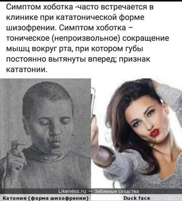 Симптом хоботка часто встречается в клинике при кататонической Форме шизофрении Симптом хоботка тоническое непроизвольное сокращение мышц вокруг рта при котором губы постоянно вытянуты вперед признак кататонии