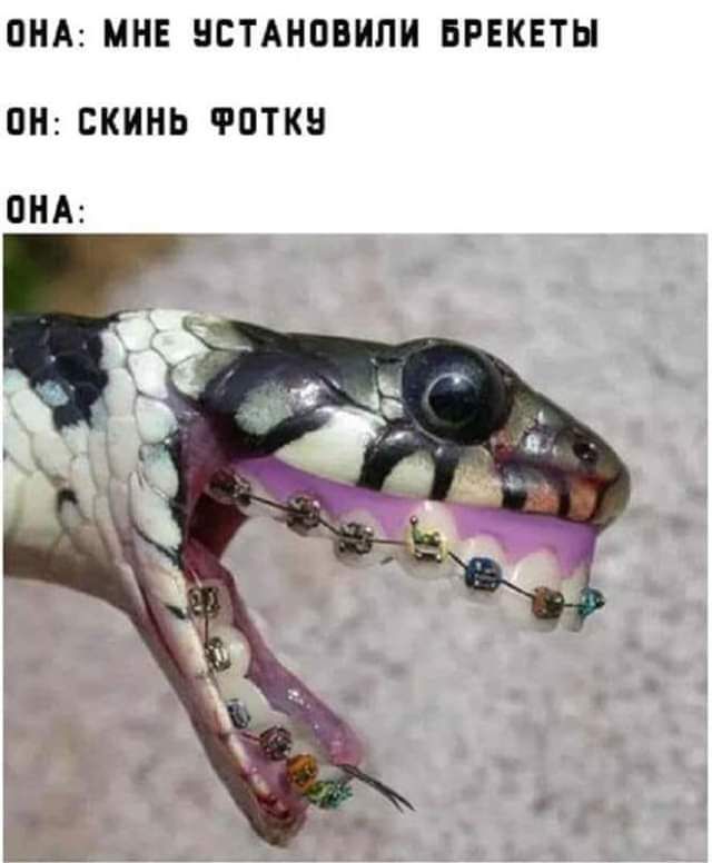 ПНА МНЕ НСТАНОВИПИ БРЕКЕТН ПН ЕКИНЬ ФПТКН ПНА